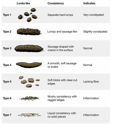 Constipation In Infants And Children Milton Keynes University Hospital