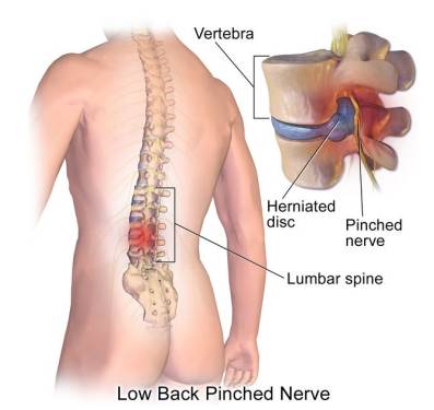 Surgical Treatment Options for Lower Back Pain Relief