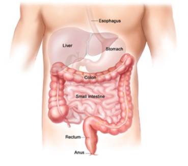 The Main Differences Between Ileostomy vs Colostomy Bag