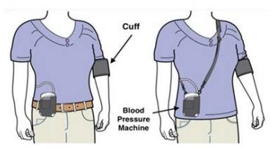 Cardiology Outpatients 24 Hour Blood Pressure Monitor - Milton